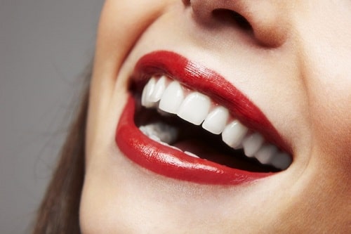 Smiling-Woman-White-Teeth.jpg